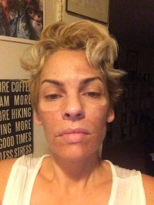 This day is when it was hard to laugh. My skin was so tight.